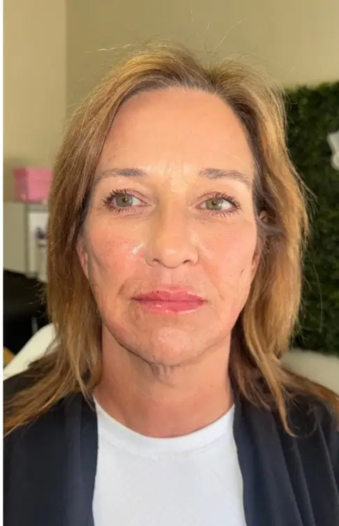 after skin aesthetics
