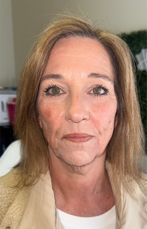 Before Skin Aesthetics