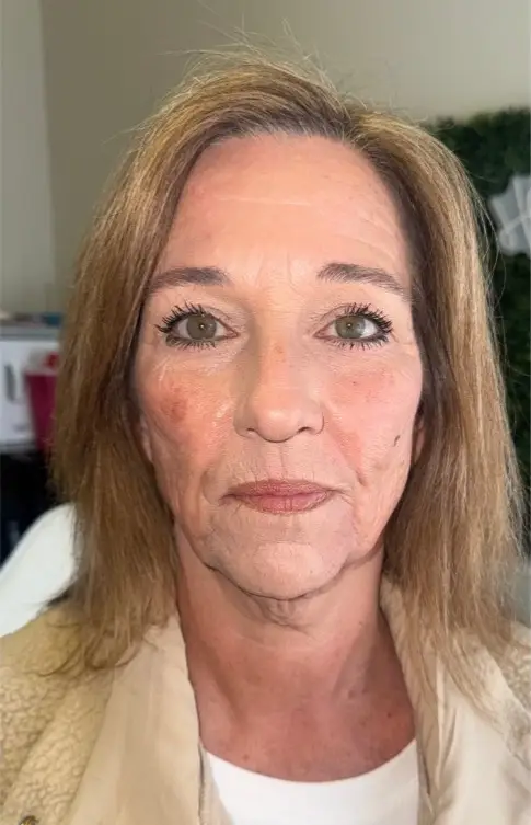 before skin aesthetics