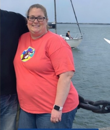 Before Weight Loss 2